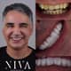 Slider image (10) Best Dental Clinic in Istanbul - Niva Aesthetic
